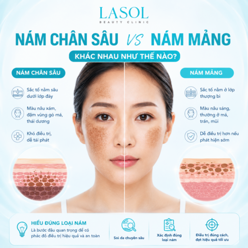 Nám chân sâu và nám mảng khác nhau như thế nào?