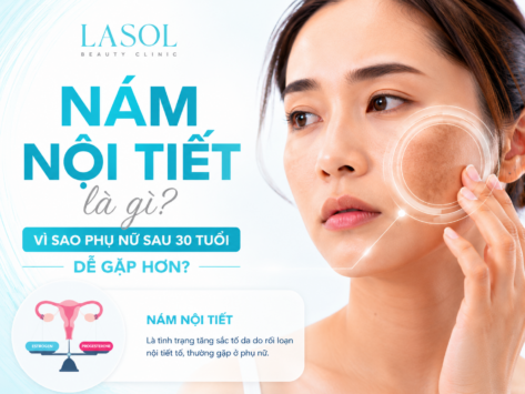 Nám nội tiết là gì? Vì sao phụ nữ sau 30 tuổi dễ gặp hơn?