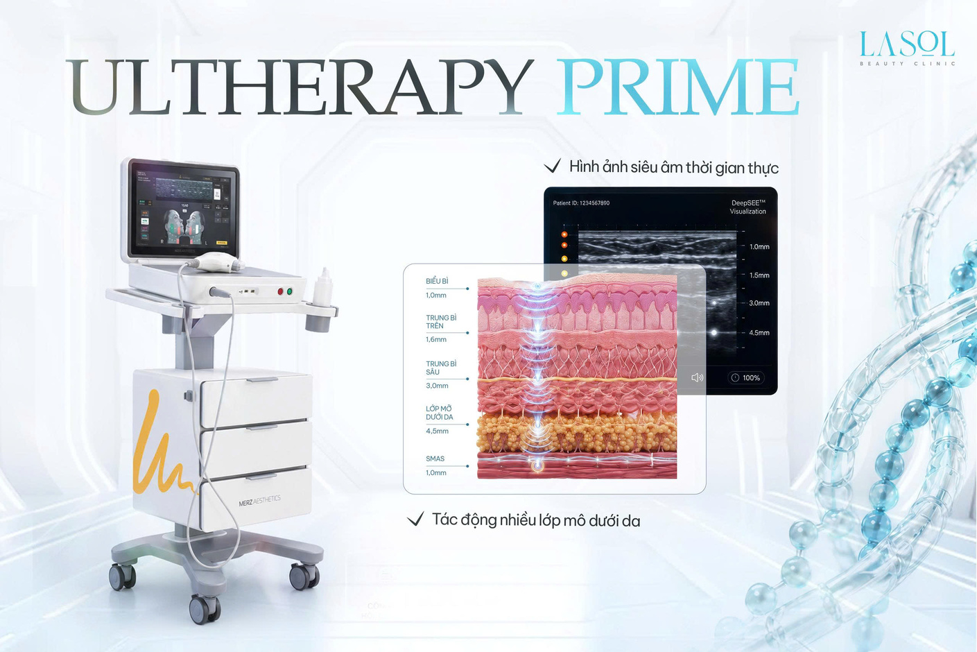 Ultherapy Prime tác động nhiều lớp mô dưới da