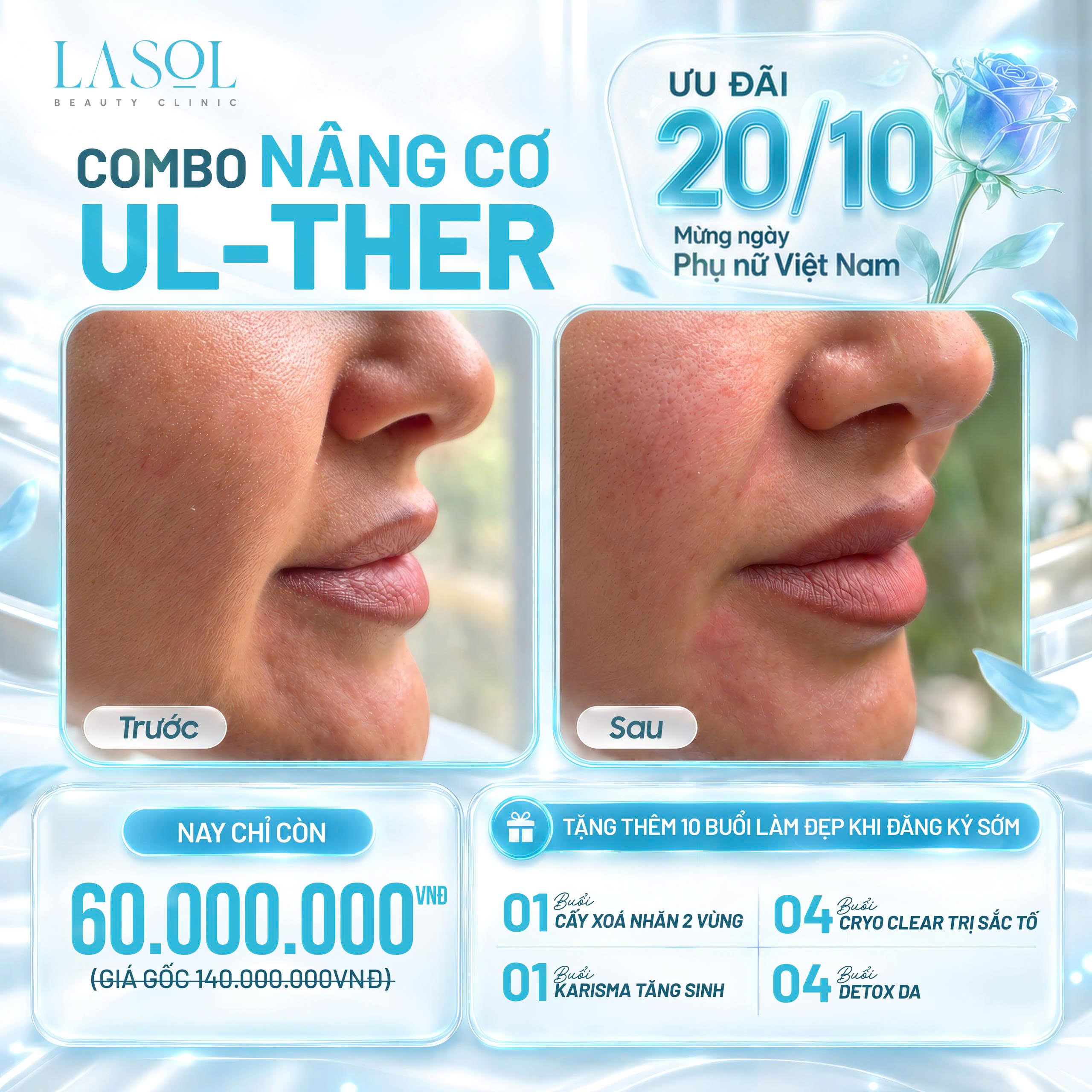 NÂNG CƠ ULTHER – ƯU ĐÃI ĐẾN 80 TRIỆU ĐỒNG