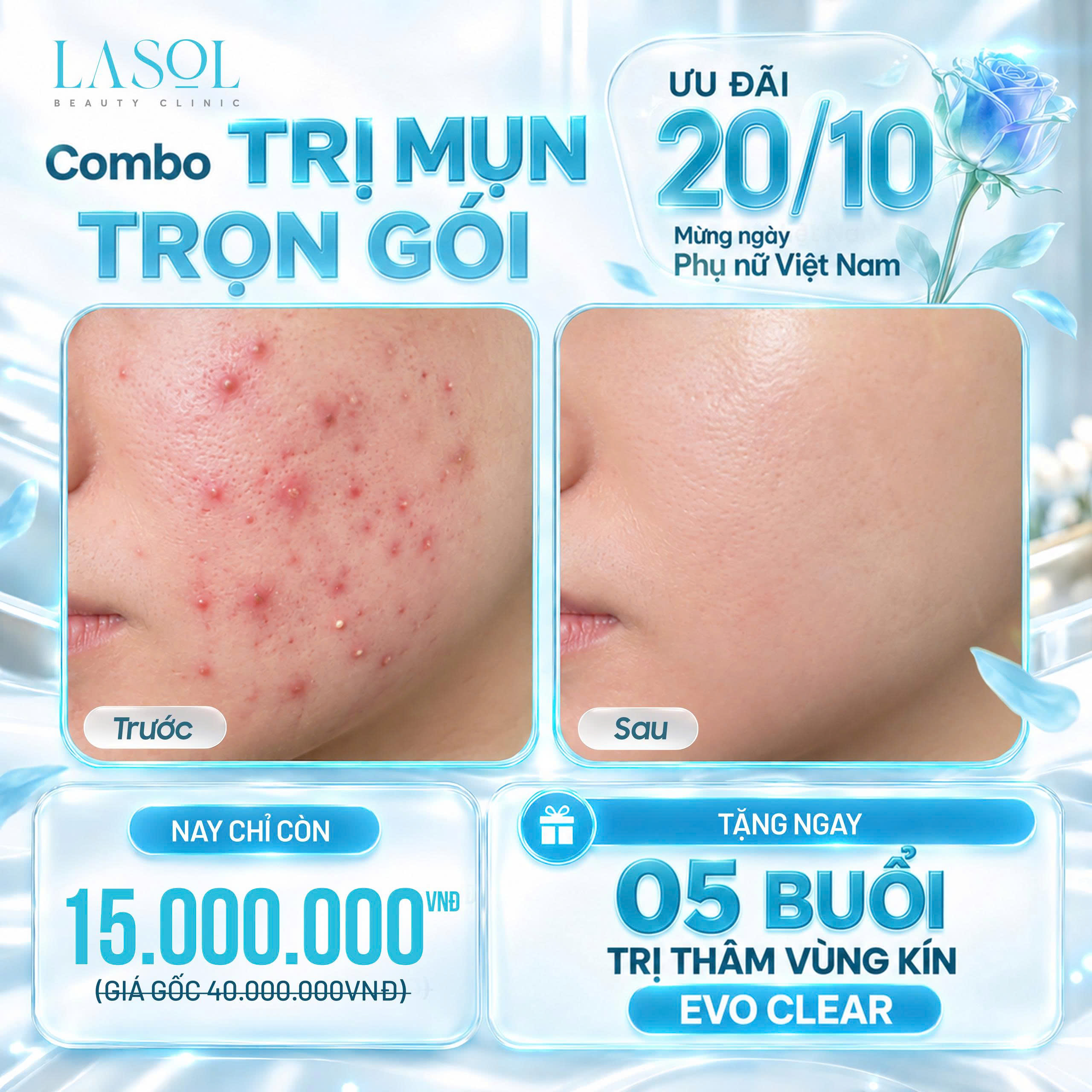 COMBO CHĂM SÓC DA MỤN – ƯU ĐÃI CHỈ 15 TRIỆU ĐỒNG